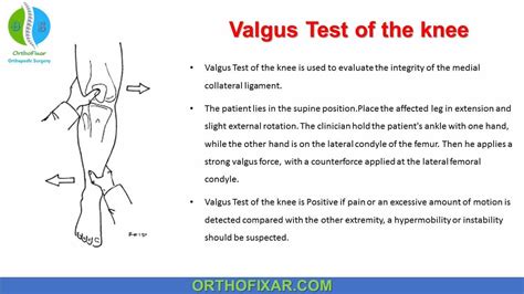 positive valgus stress test